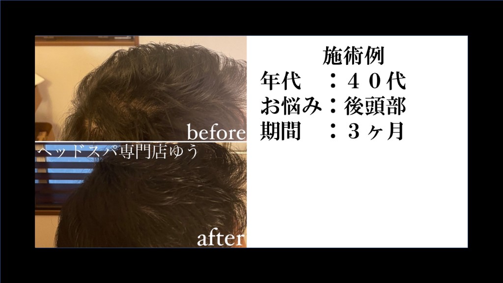 Before & After 1