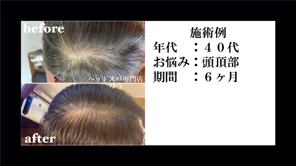 Before & After 14