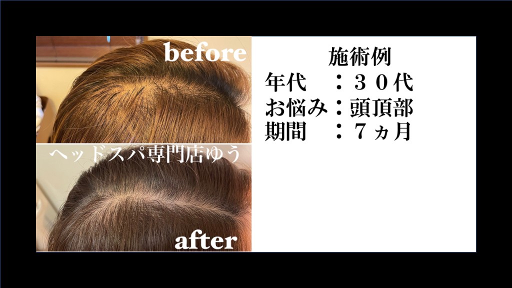 Before & After 15